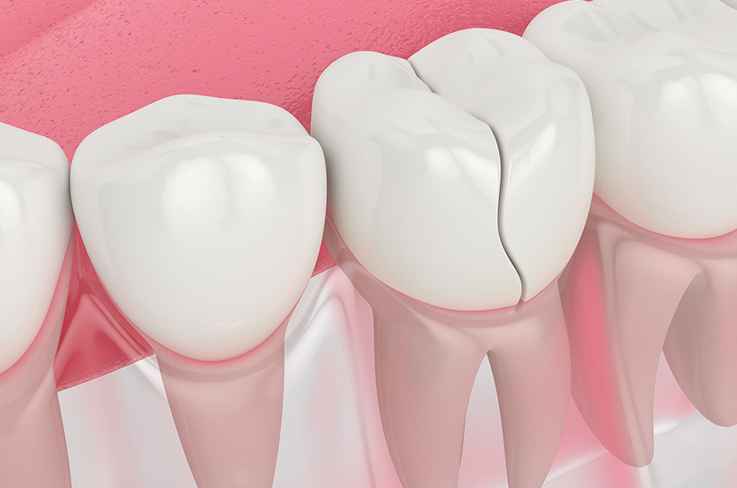 Osuna Dental Care Osuna Dental Care