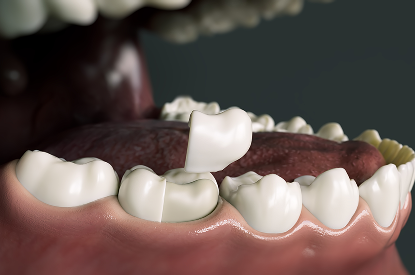 Osuna Dental Care Osuna Dental Care