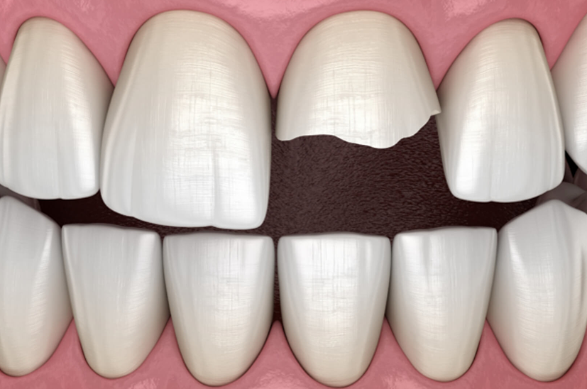 Osuna Dental Care Osuna Dental Care