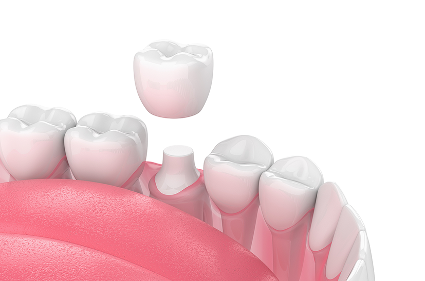 Osuna Dental Care Osuna Dental Care
